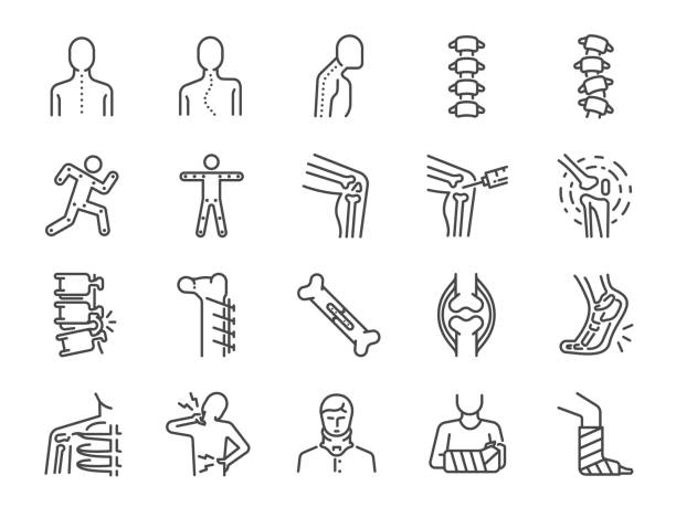 orthopädie-linie-icon-set. die symbole wie arthrose, medizinische reha, plantarfasziitis, rückenverletzungen, fraktur und vieles mehr enthalten. - surgery stock-grafiken, -clipart, -cartoons und -symbole