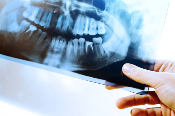 istock to study an x-ray of teeth, toned 1088251530
