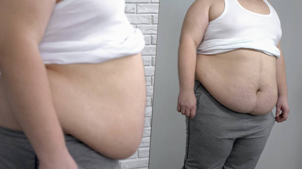 istock Overweight male in white shirt looking at mirror reflection, obesity problem 1088257946