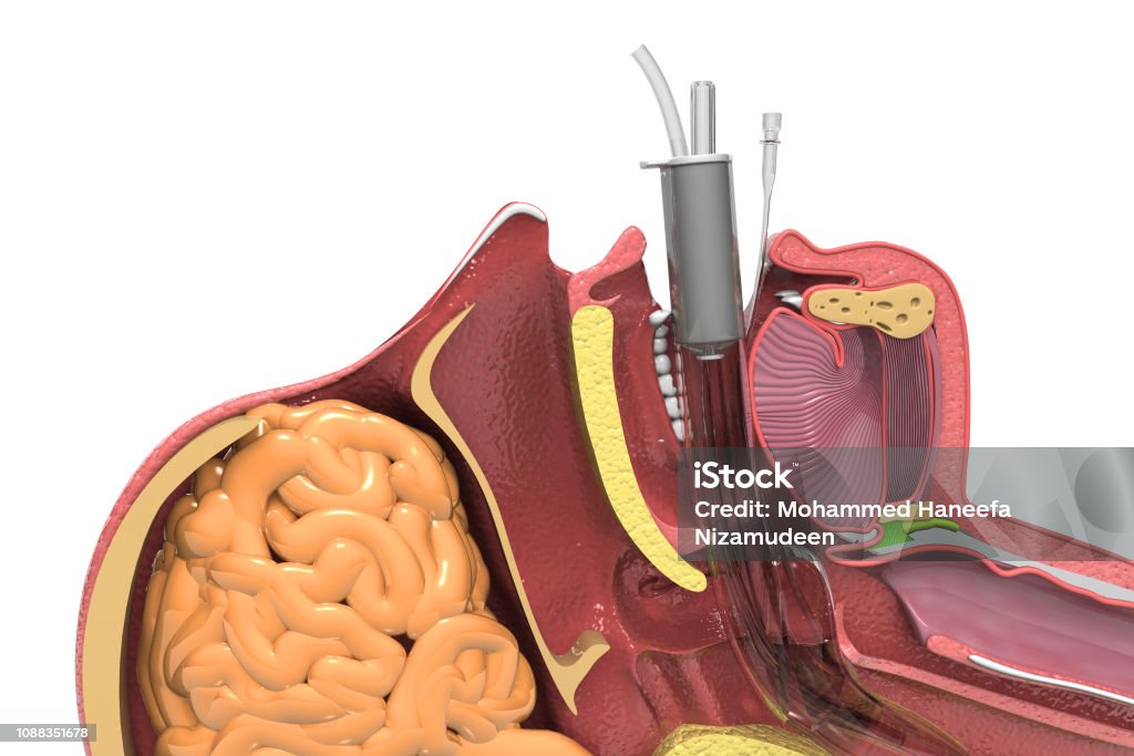 Endotracheal Intubation. Human head cross section Larynx Stock Photo