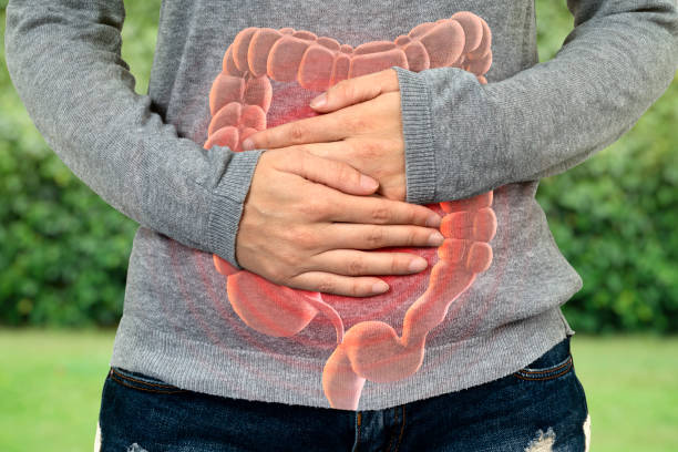 large intestine problem - inflammation imagens e fotografias de stock