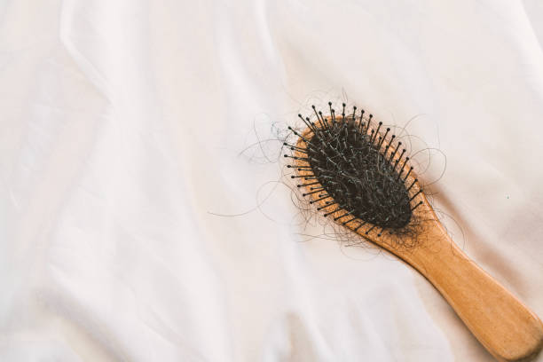 istock comb and problem hair loss sitting on bed at bedroom 1088983724