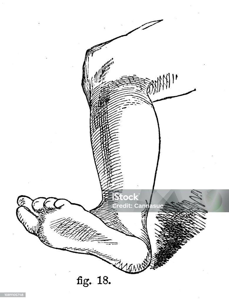 Victoria siyah beyaz basit çizgi çizme gölgelendirmek nasıl gösteren bir bacağımı; çizim ve teknikleri anatomi tarafından Robert Scott yakmak 1860 Self-Aid ansiklopedi üzerinden için gölgelendirme. - Royalty-free Ayak Stock Illustration
