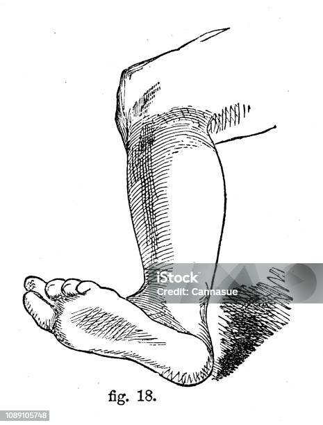 Victoria Siyah Beyaz Basit Çizgi Çizme Gölgelendirmek Nasıl Gösteren Bir Bacağımı Çizim Ve Teknikleri Anatomi Tarafından Robert Scott Yakmak 1860 Selfaid Ansiklopedi Üzerinden Için Gölgelendirme Stok Vektör Sanatı & Ayak‘nin Daha Fazla Görseli