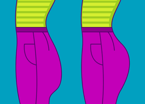 Female buttocks before and after Female buttocks before and after correction of implants, changing shape of bottom with sports exercises, problem of flat ass. Vector illustration silicone implants stock illustrations