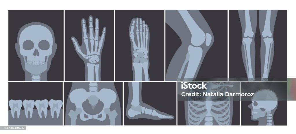 Vector illustration of realistic set of many X-rays pictures of human body. Transparent X-ray photos on white background. Vector illustration of realistic set of many X-rays pictures of human body. Transparent X-ray photos on white background Human Skeleton stock vector