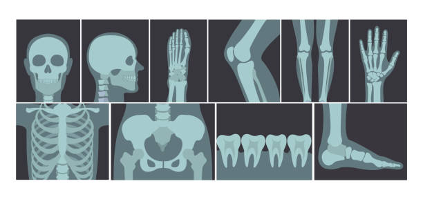 vektor-illustration-set viele röntgen-aufnahmen des menschlichen körpers, röntgenaufnahmen von kopf, händen, beinen und anderen teilen des körpers auf weißem hintergrund. - x ray x ray image human hand anatomy stock-grafiken, -clipart, -cartoons und -symbole