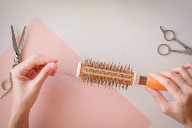 istock hair fall and lost alopecia woman problem on the comb. 1090490322