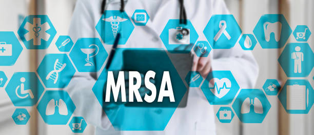istock Medical Doctor with stethoscope and word MRSA ,Methicillin-Resistant Staphylococcus Aureus in Medical network connection on the virtual screen on hospital background.Technology and medicine concept. 1090809262