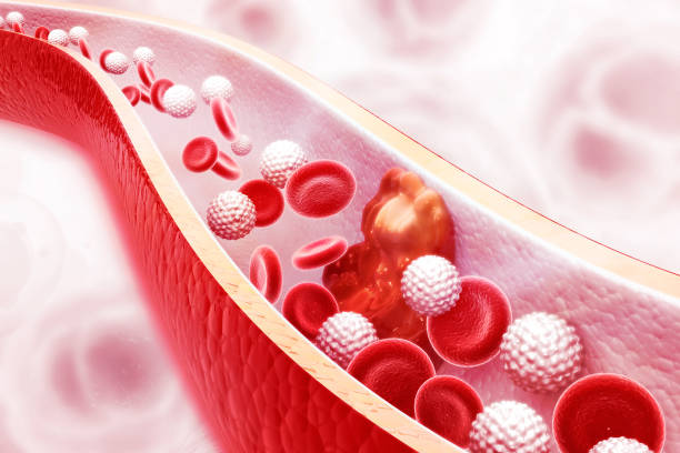 istock Cholesterol plaque in artery on science background 1090835740