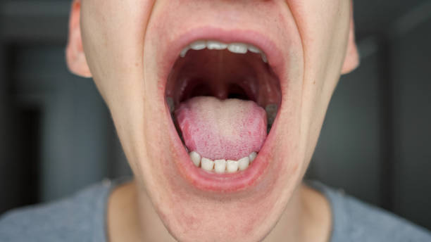 gros plan des dents et bouche mâle - sticking out tongue photos et images de collection