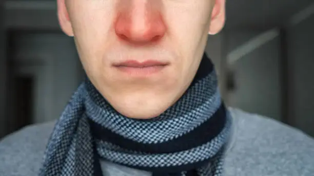 Unrecognizable sick guy in warm scarf with a red nose.