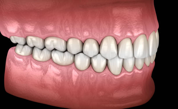 istock Healthy human teeth with normal occlusion, side view. Medically accurate tooth 3D illustration 1091303732