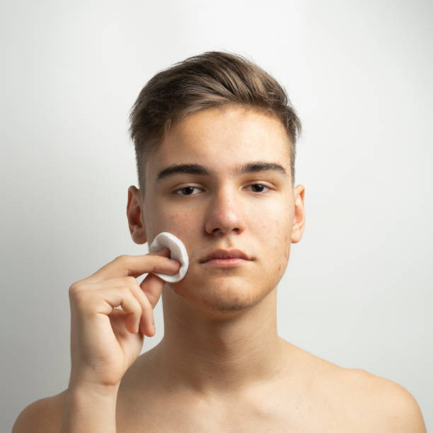 istock a teenager with pimples and acne on face 1091441584