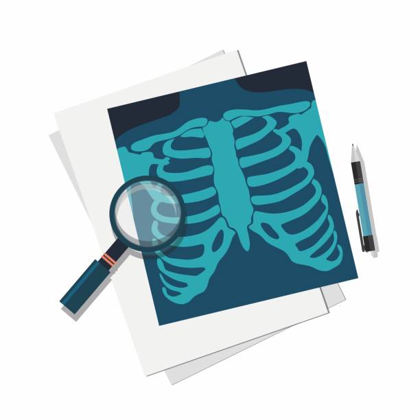 koncepcja medycyny. płuca rentgenowskie, lupa i długopis. - x ray equipment x ray machine radiation stock illustrations