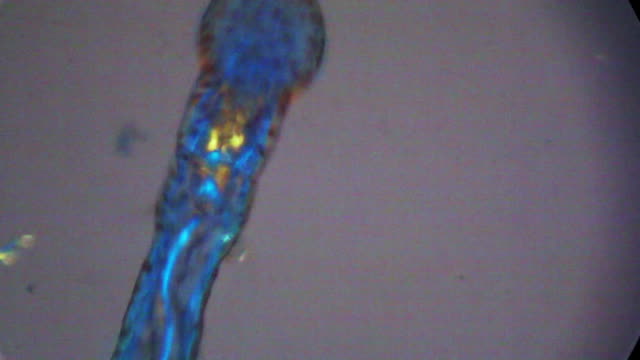 Oligochaete worm under the microscope.