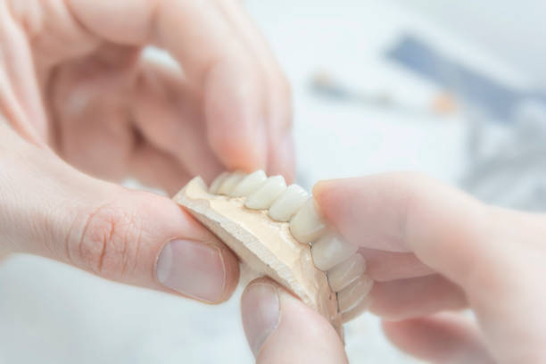 istock Medical tooth dental technician holding prosthetic in laboratory 1092100108