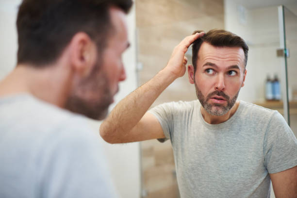 reife männer ist besorgt über haarausfall - glatzenbildung stock-fotos und bilder
