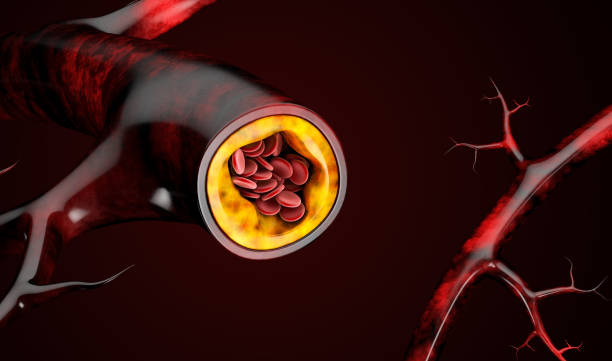 3d abbildung blutkörperchen mit plaque-bildung von cholesterin - cholesterin stock-fotos und bilder