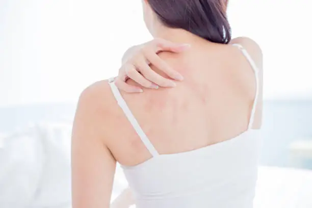 Photo of woman scratching shoulder and neck