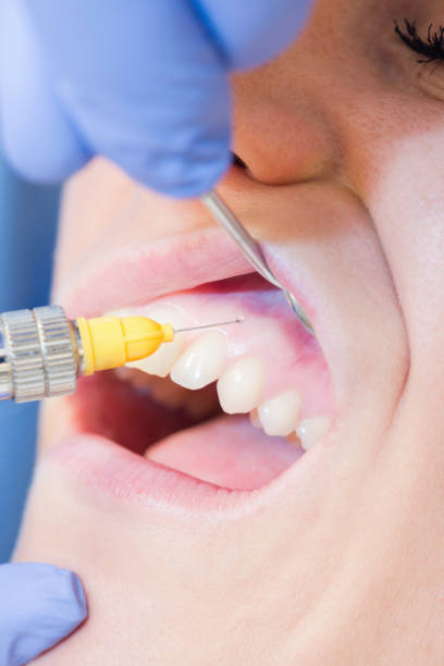istock Close-Up Of Dentist Examining Patient Teeth 1093116614