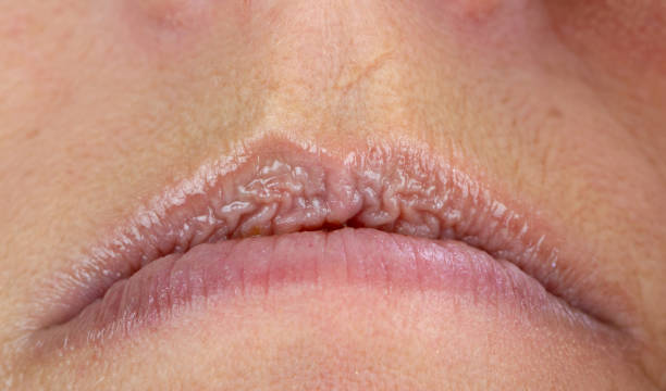 istock Woman mouth with retracted lips giving an atypical effect 1093748900