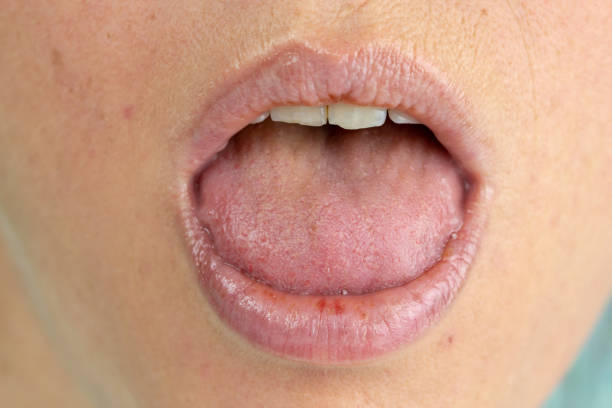 istock Woman sticking her tongue out 1093748908