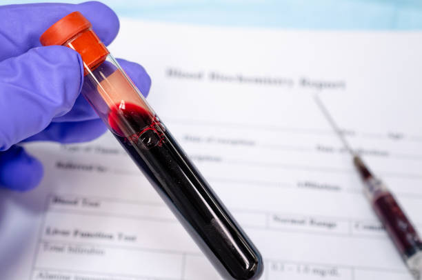 Blood collection for pathological, biochemistry test Blood in a blood collection vial with blood biochemistry profile and syringe at the background nephropathy photos stock pictures, royalty-free photos & images