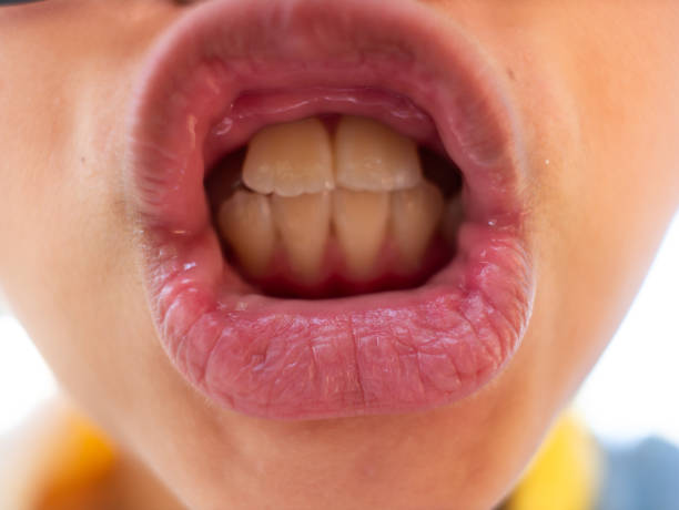 istock Girl Opened The Mouth 1093954158
