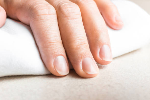 istock Woman hand with unpainted fingernails preparing manicure 1093956682