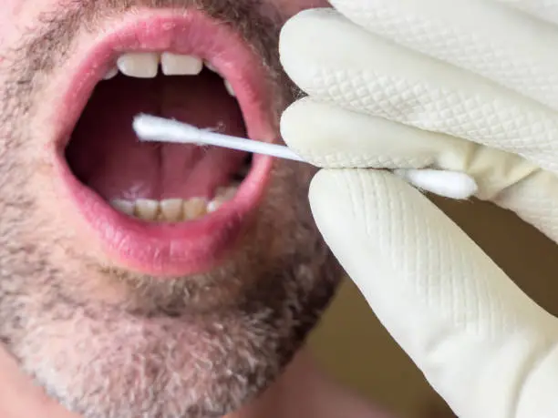 DNA test swab saliva sample