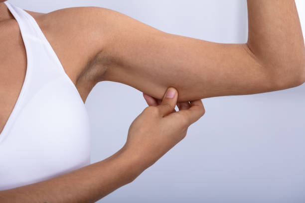 istock Woman Checking Excessive Fat On Her Arms 1094155424