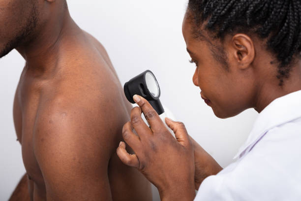 Close-up Of A Doctor Checking Pigment Skin On Man's Back Close-up Of A Female Doctor Checking Pigment Skin On Man's Back With Dermatoscope skin cancer stock pictures, royalty-free photos & images