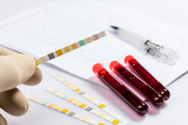 test tubes with blood - doping imagens e fotografias de stock