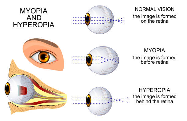 zdrowe oko, oko, krótkowzroczność i nadwzroczność - optics store stock illustrations