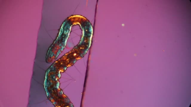 Oligochaete worm swimming in polarized light under a microscope.