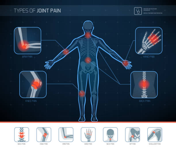 illustrations, cliparts, dessins animés et icônes de types de douleurs articulaires infographique - articulation du corps humain