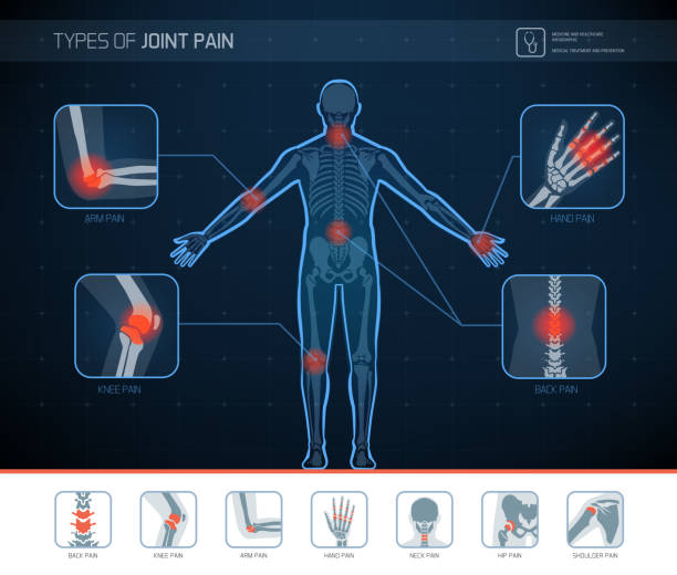 Types of joint pain infographic Types of joint pain medical infographic with icons human joint stock illustrations