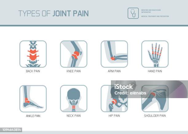 Tipi Di Dolori Articolari - Immagini vettoriali stock e altre immagini di Giuntura - Giuntura, Icona, Dolore fisico