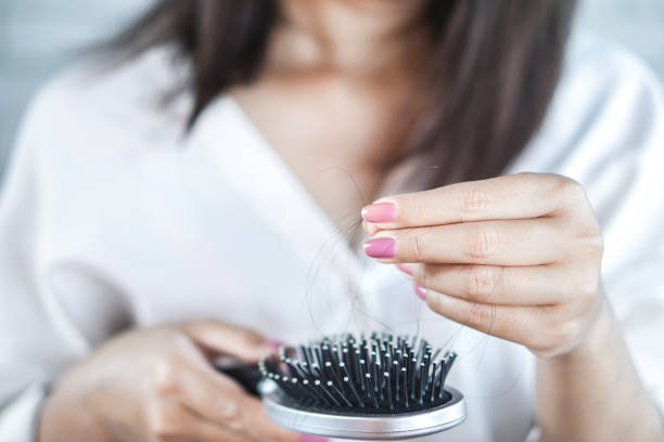 istock woman having problem with hair loss hand holding hair fall on comb 1094905312