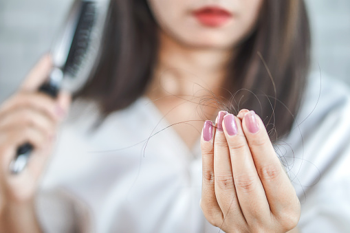 mano de mujer con la caída del cabello de cepillo para el pelo photo