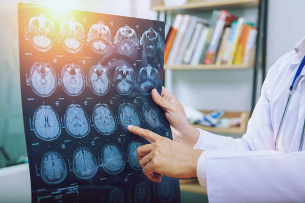 istock doctor give advice to patient about MRI (Xray) brain Scans 1094966384