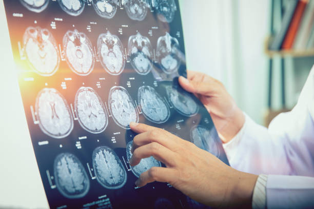istock doctor give advice to patient about MRI (Xray) brain Scans 1094966418