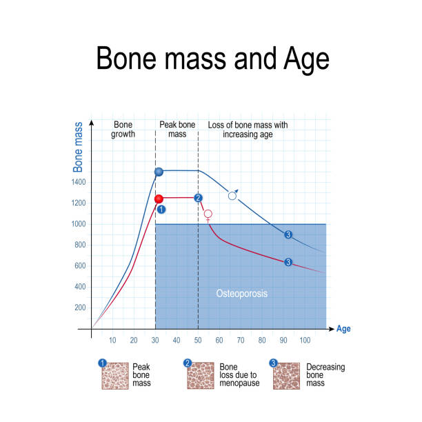 ilustrações de stock, clip art, desenhos animados e ícones de bone mass for male and female. age and osteoporosis. chart. - mount pore