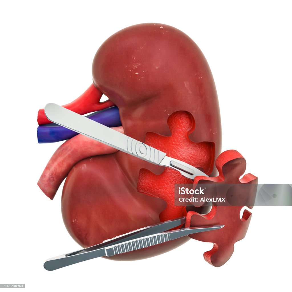 Foto de Conceito De Cirurgia De Rim 3d Renderização Isolado No