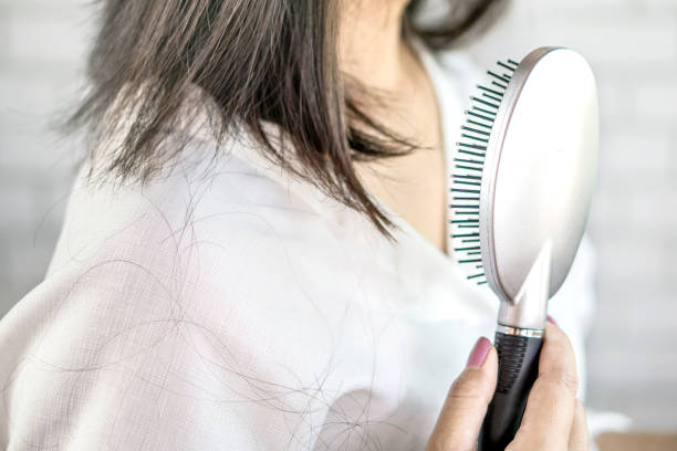 istock woman having problem hair loss falling on shoulder and hairbrush 1095952886