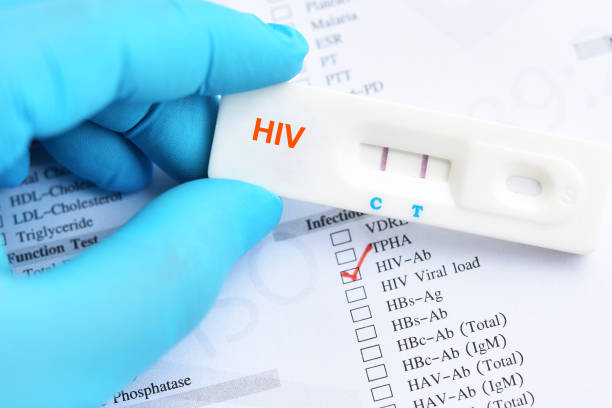 HIV positive test result HIV positive test result by using rapid test cassette sexually transmitted disease stock pictures, royalty-free photos & images