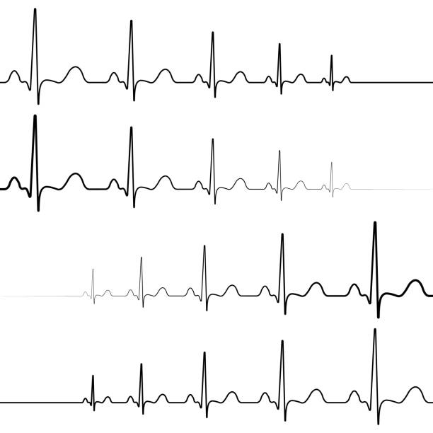 Set icons symbol death resurrection, vector, symbol heartbeat attenuation and resuming of the heart beats Set of icons a symbol of death and resurrection, vector, symbol heartbeat attenuation and resuming of the heart beats heartbeat line stock illustrations