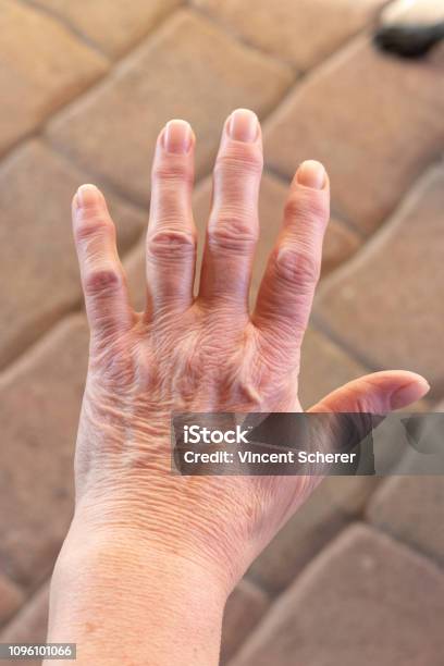 These Are Hands Of A Old Woman With Finger Pain Stock Photo - Download Image Now - Adult, Adults Only, Aging Process