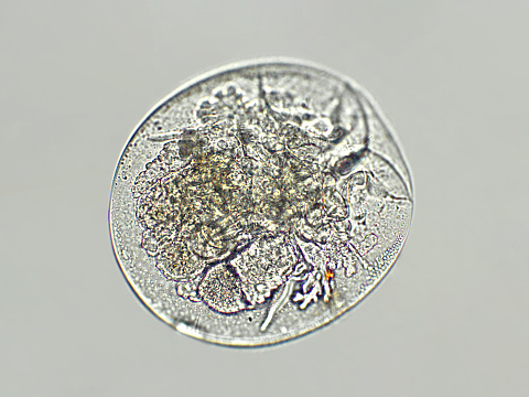 Microzooplankton under microscopic view, zooplankton